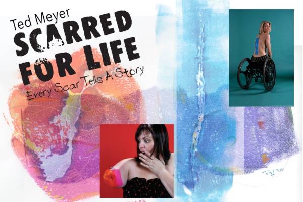 Ted Meyer Scarred For Life